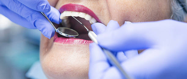 Best Emergency Dental Care for Broken or Chipped Teeth in Greenwood, MO